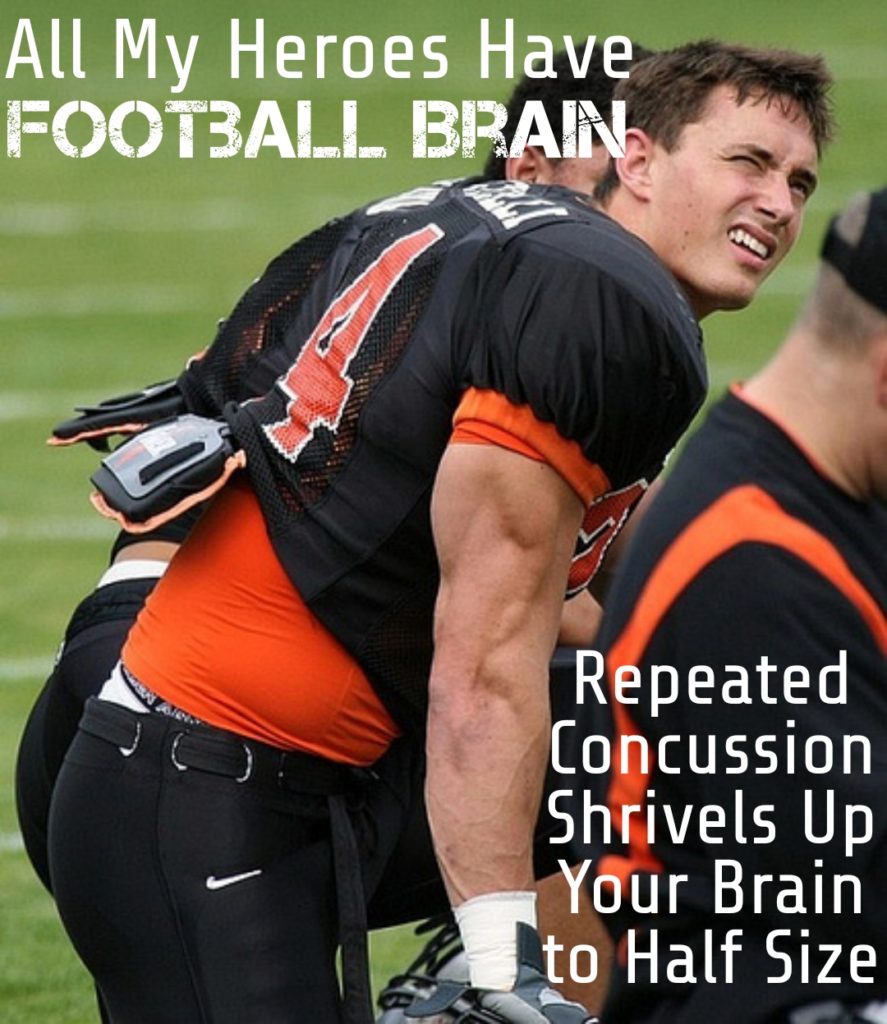 All My Heroes Have FOOTBALL BRAIN
Repeated Concussion Shrivels Up Your Brain to Half Size